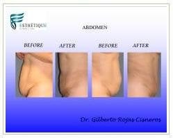 Slider image (2) Esthetique Clinic and Spa